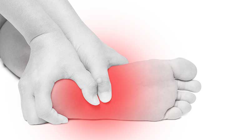 Plantar Fasciitis Treatment in Hayward